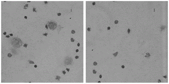 Breast cancer cell dyeing method, application thereof and dyeing kit