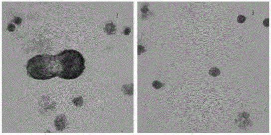 Breast cancer cell dyeing method, application thereof and dyeing kit