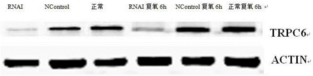 Application of TRPC6 in preparation of medicament for diagnosing and treating kidney ischemic reperfusion injury