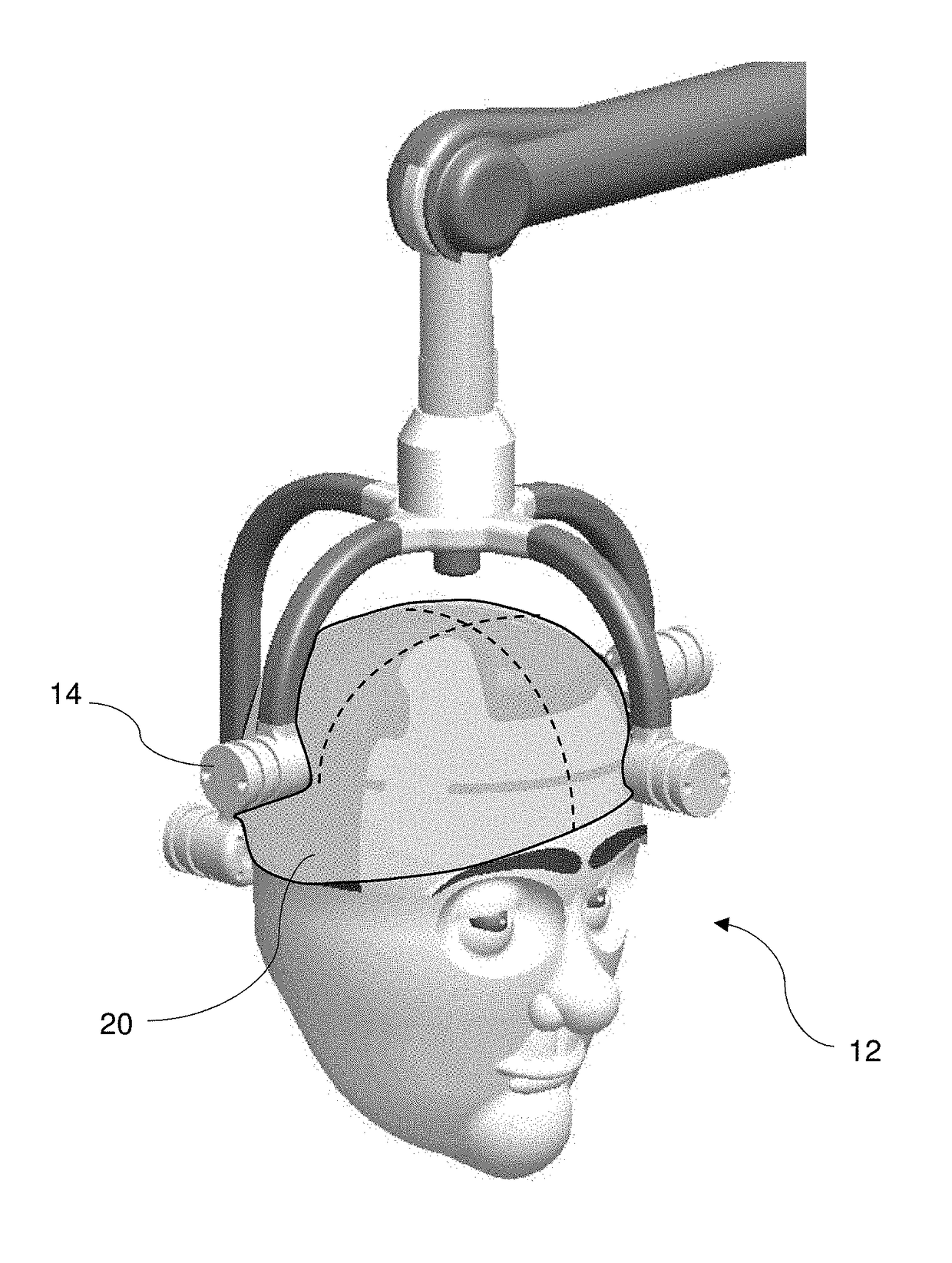 Treatment of Neurodegenerative Diseases Using Light Therapy