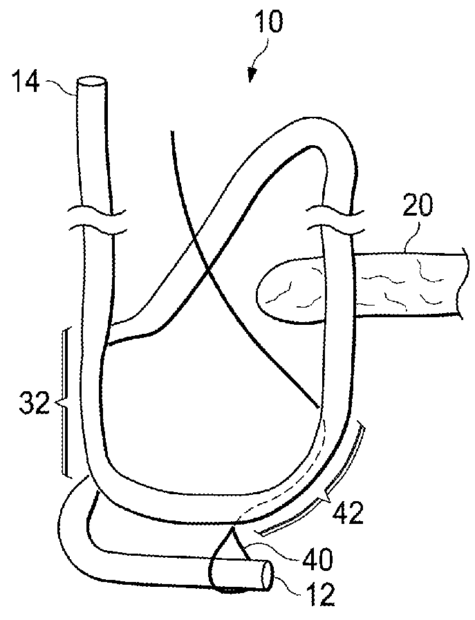 Knotless all suture tissue repair