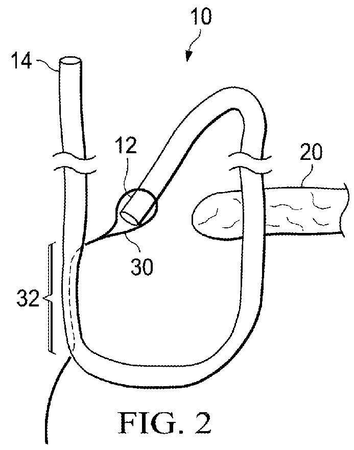 Knotless all suture tissue repair