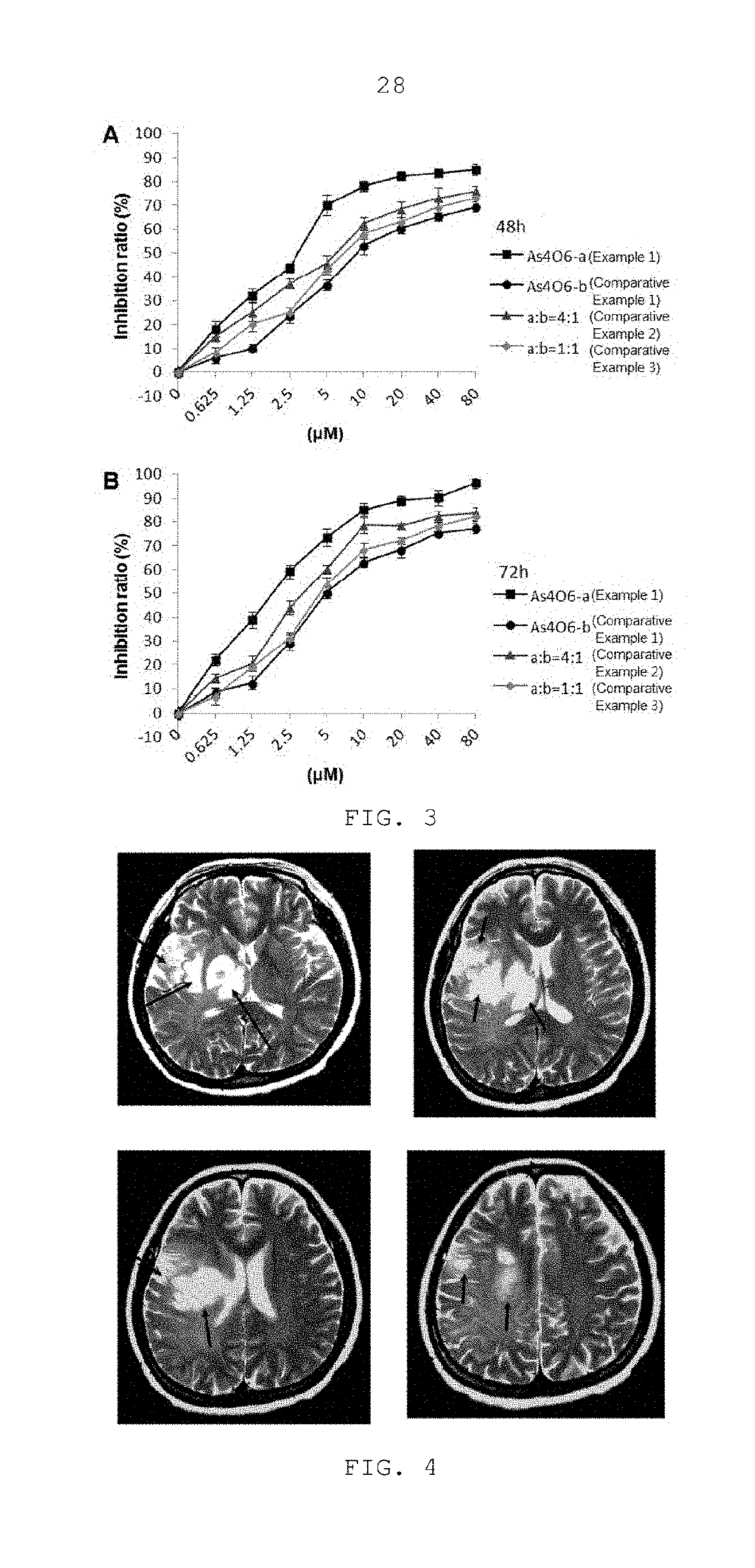 Pharmaceutical composition for preventing or treating brain cancer including crystal polymorph of tetraarsenic hexoxide, and method for preparing same