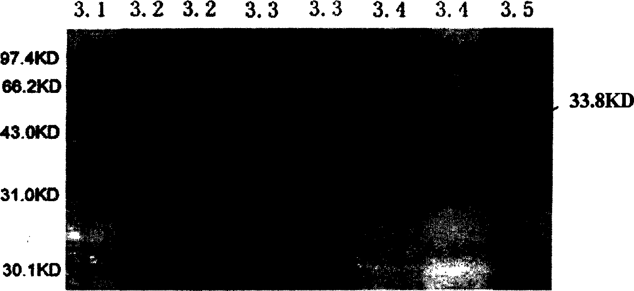 Gene of streptokinase, recombination protein and preparation method