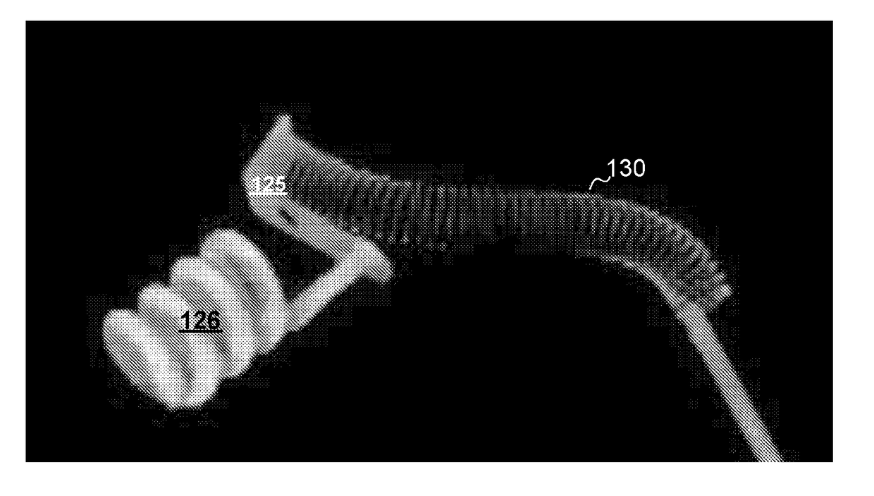 Implanted electrical lead for pacemaker