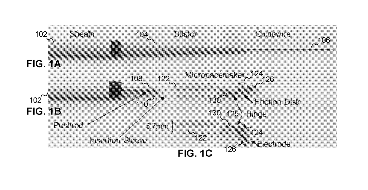 Implanted electrical lead for pacemaker