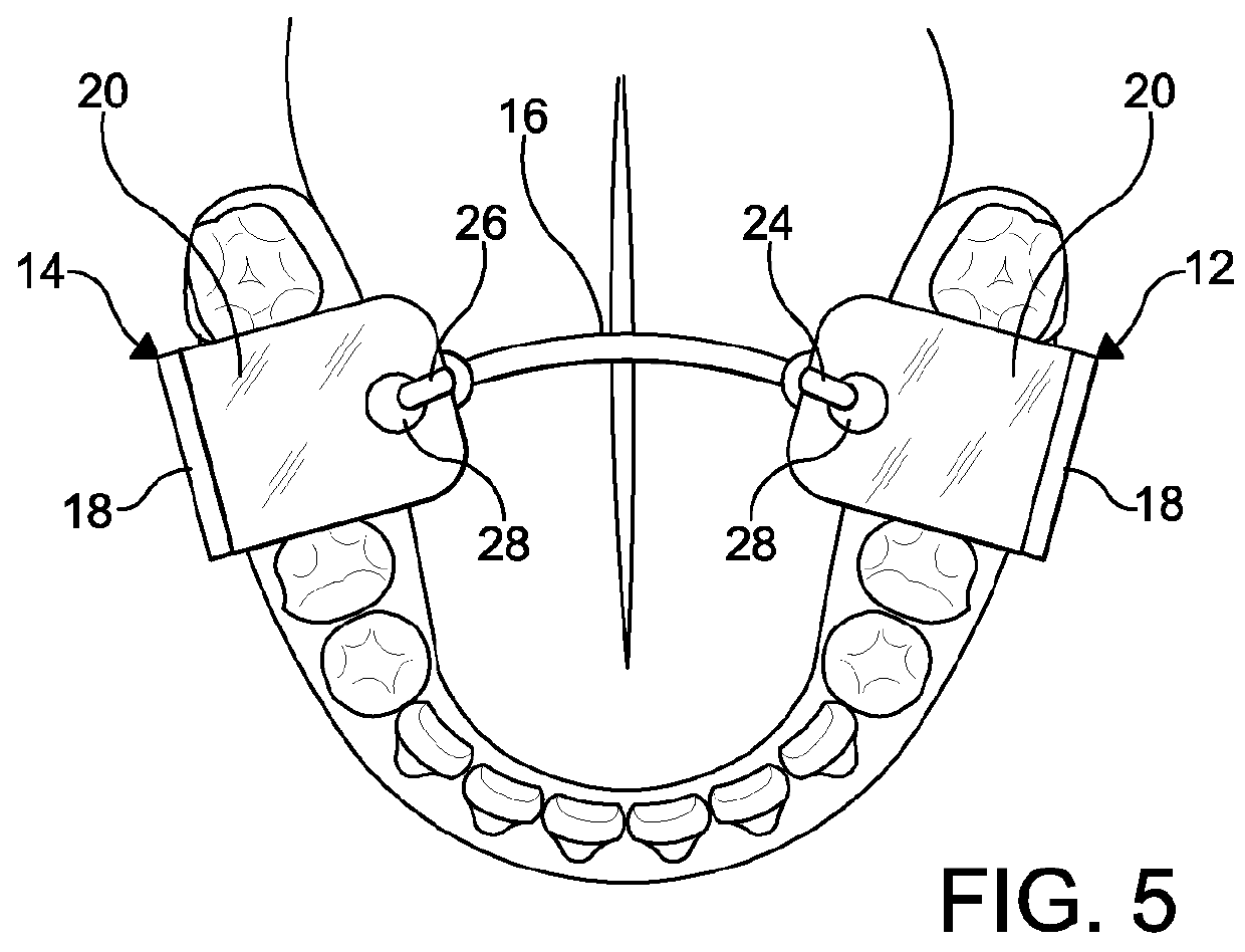 Speech therapy device