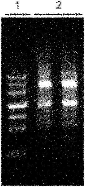 Method for rapidly extracting total ribonucleic acid from blood