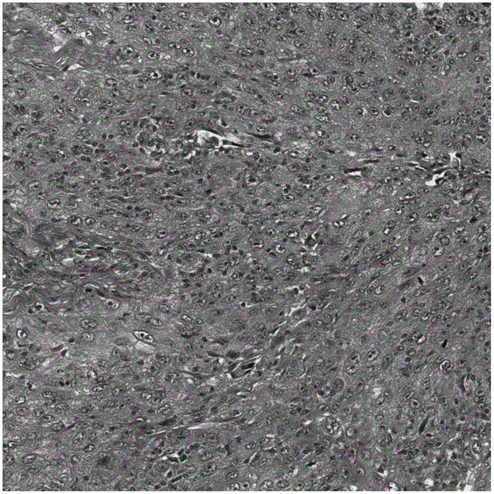 Breast cancer pathology image mitosis nucleus automatic segmentation method