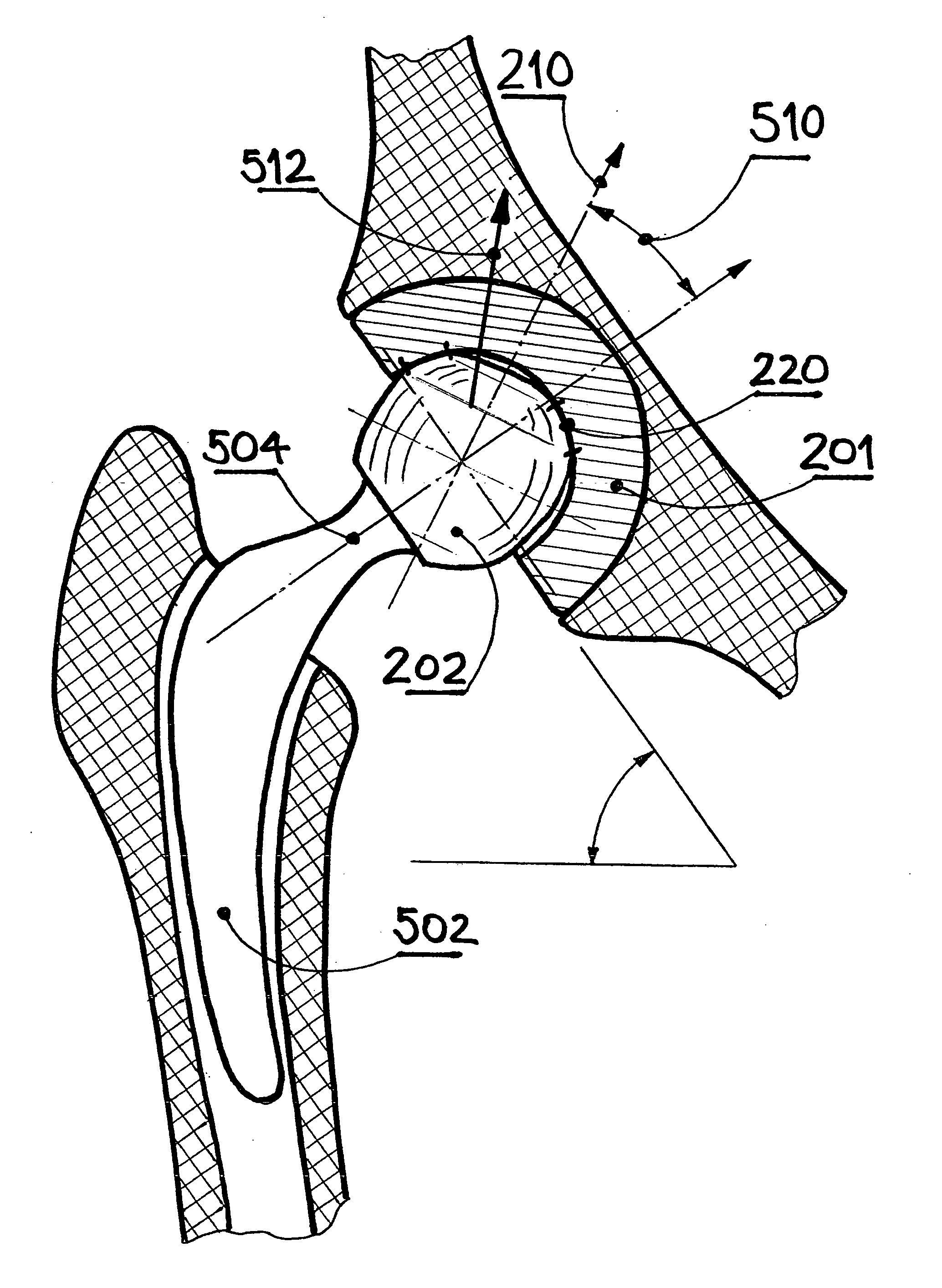 Wear-reducing geometry of articulations in total joint replacements