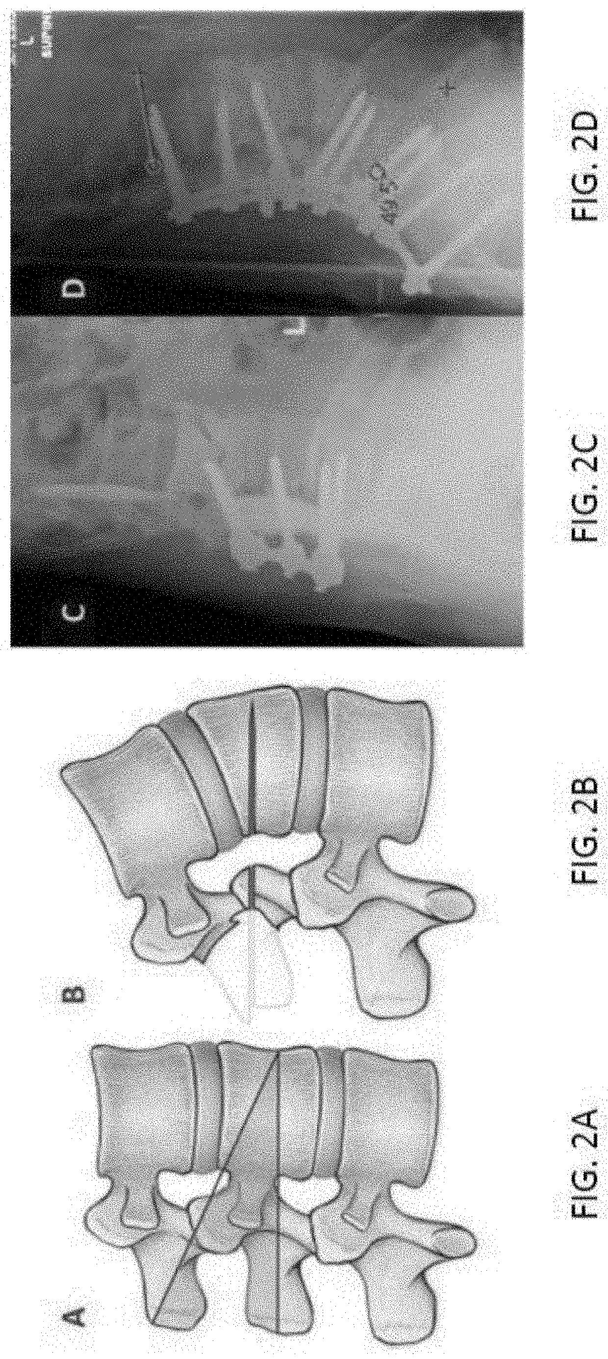 Robotic surgical systems and methods