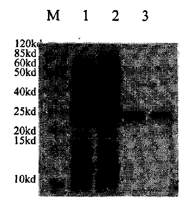 Anti-CD 20 embedded antibody mutant gene and its use