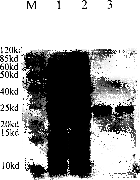 Anti-CD 20 embedded antibody mutant gene and its use