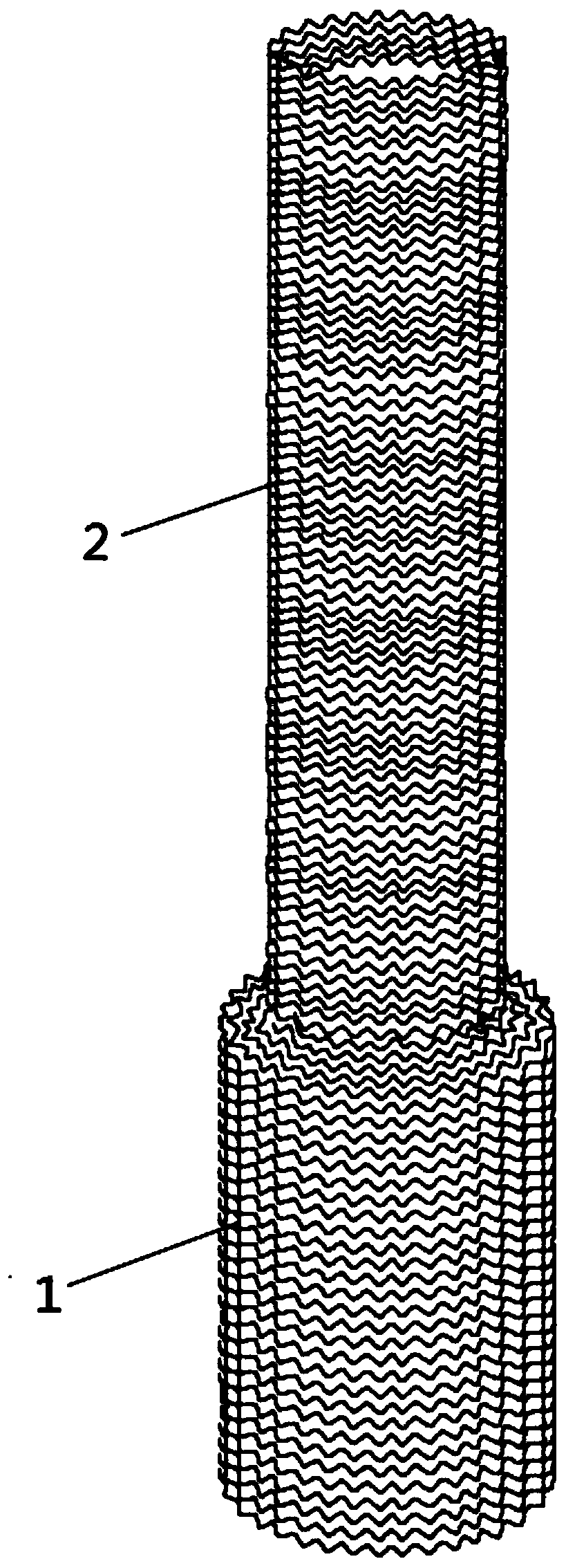 Nickel-titanium alloy stent for treating megacolon