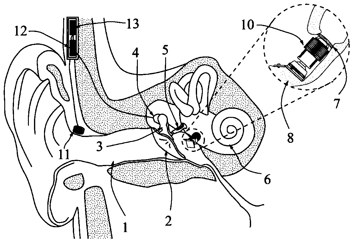 A round window-excited artificial middle ear actuator with monitorable initial pressure