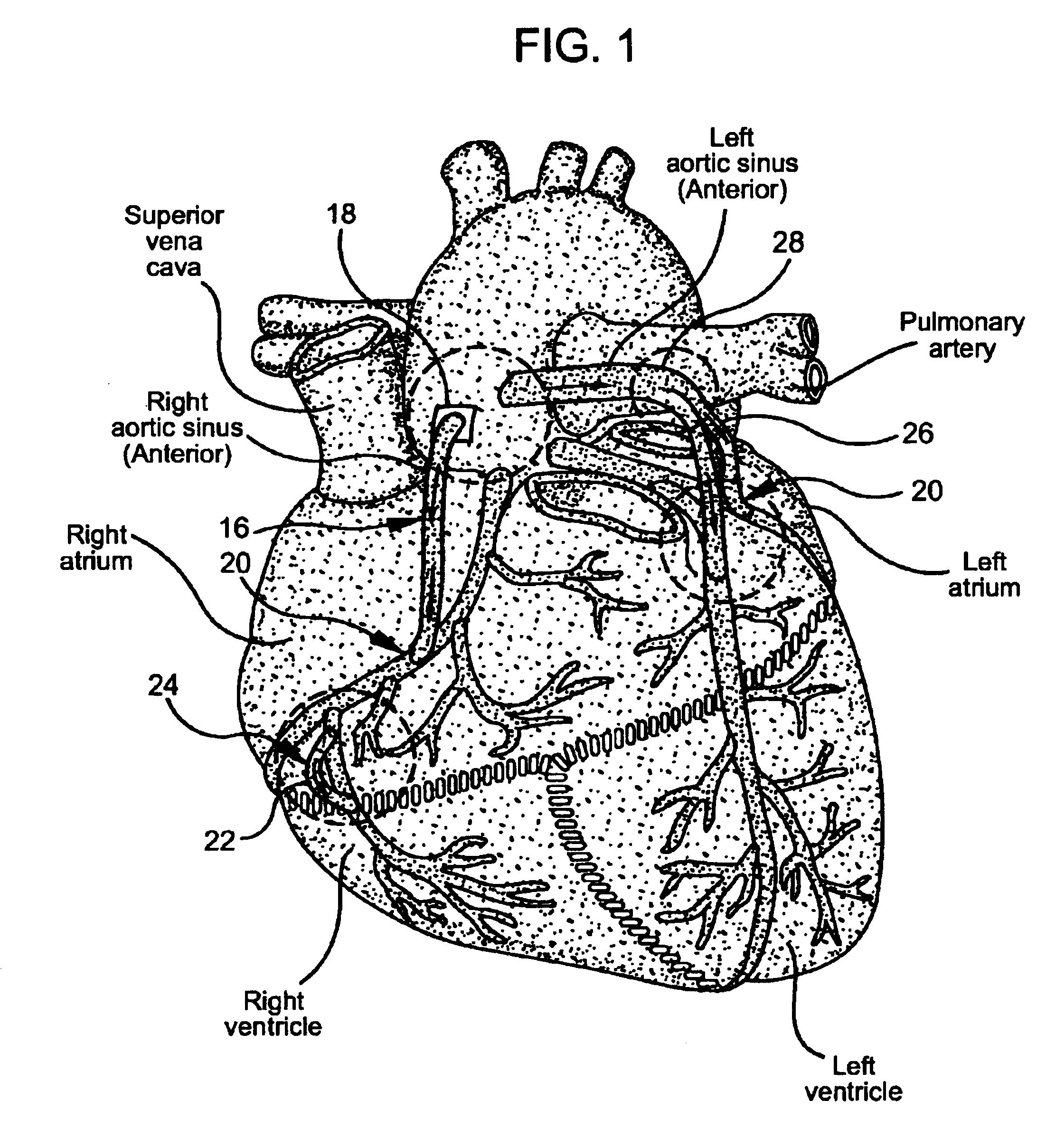 Sutureless anastomosis systems