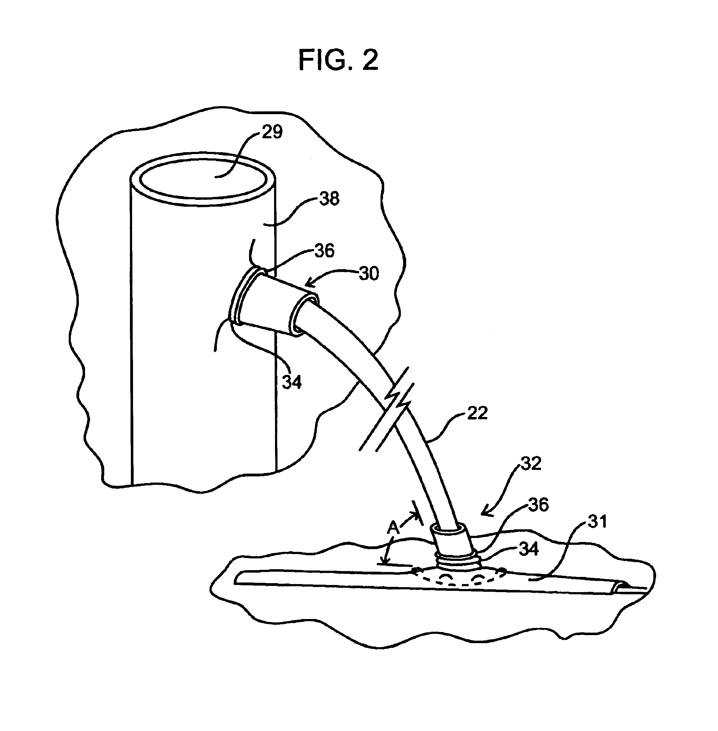 Sutureless anastomosis systems