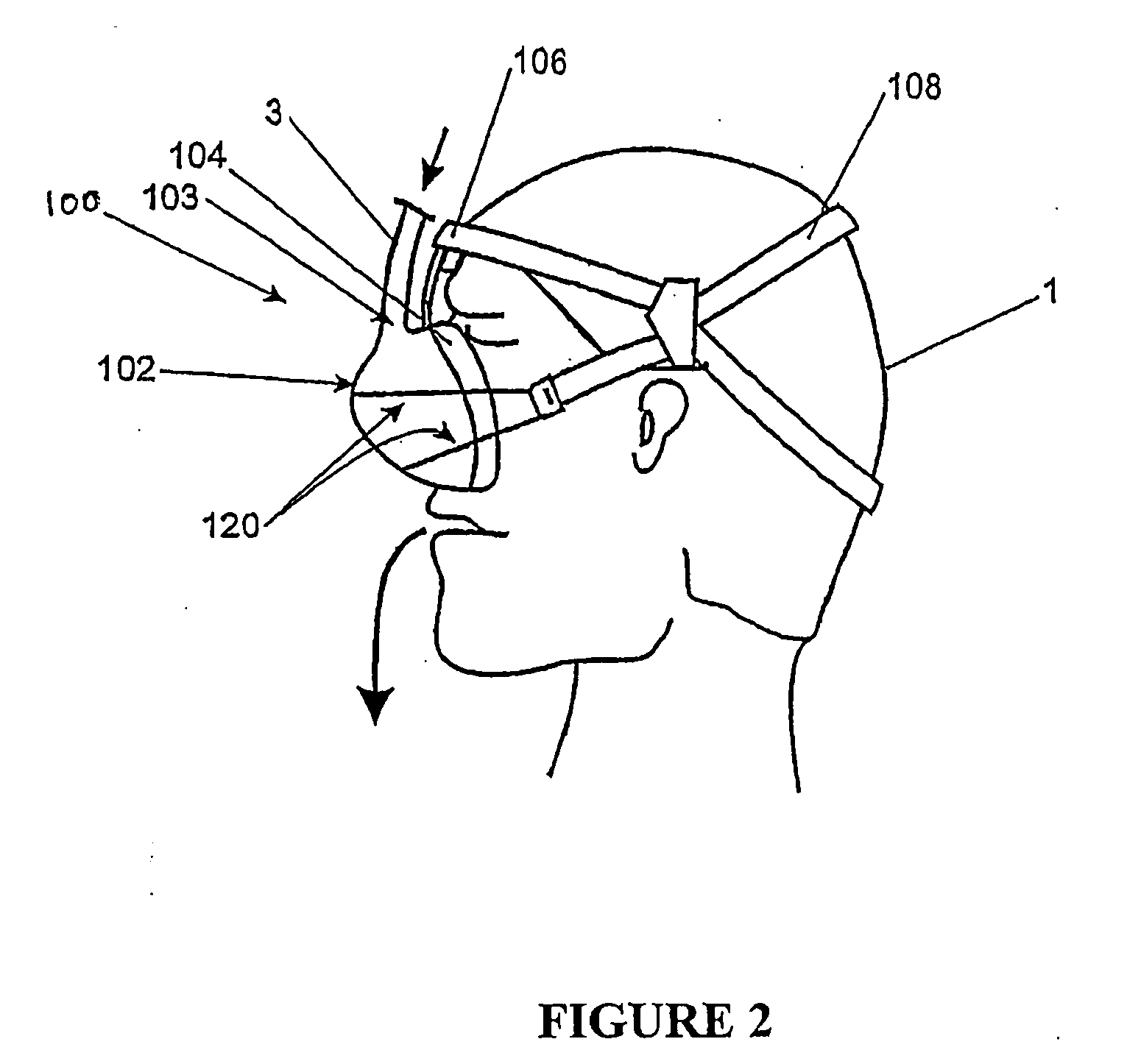 Breathing assistance apparatus