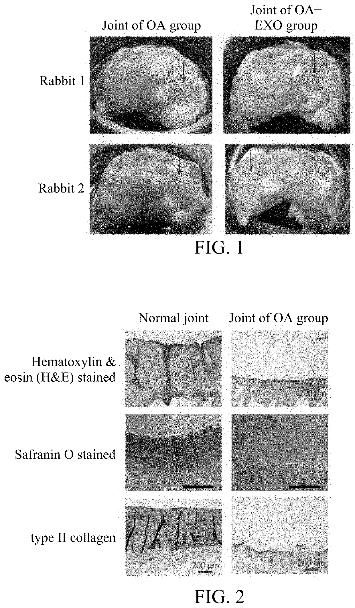 Mesenchymal stem cell derived exosomes and method for preventing or treating a joint disorder by administering a composition comprising the same