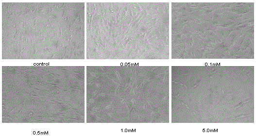 Application of dencichine in preparation of medicament for treating neurodegenerative diseases