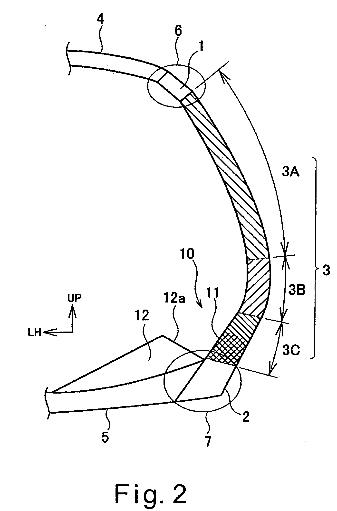 Vehicle body structure