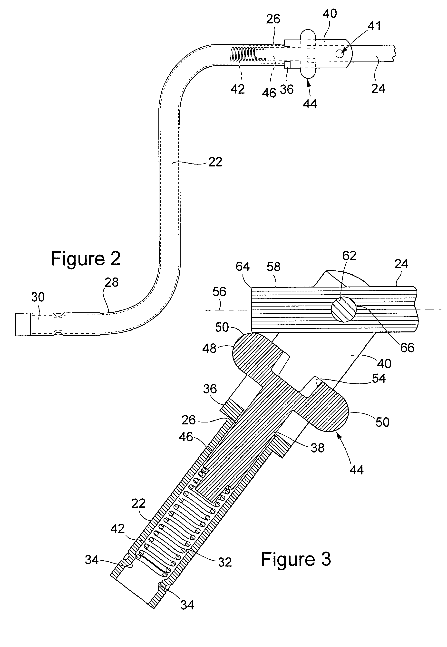 Speed Crank Projection Lock Device for Trailer Landing Gear Assembly