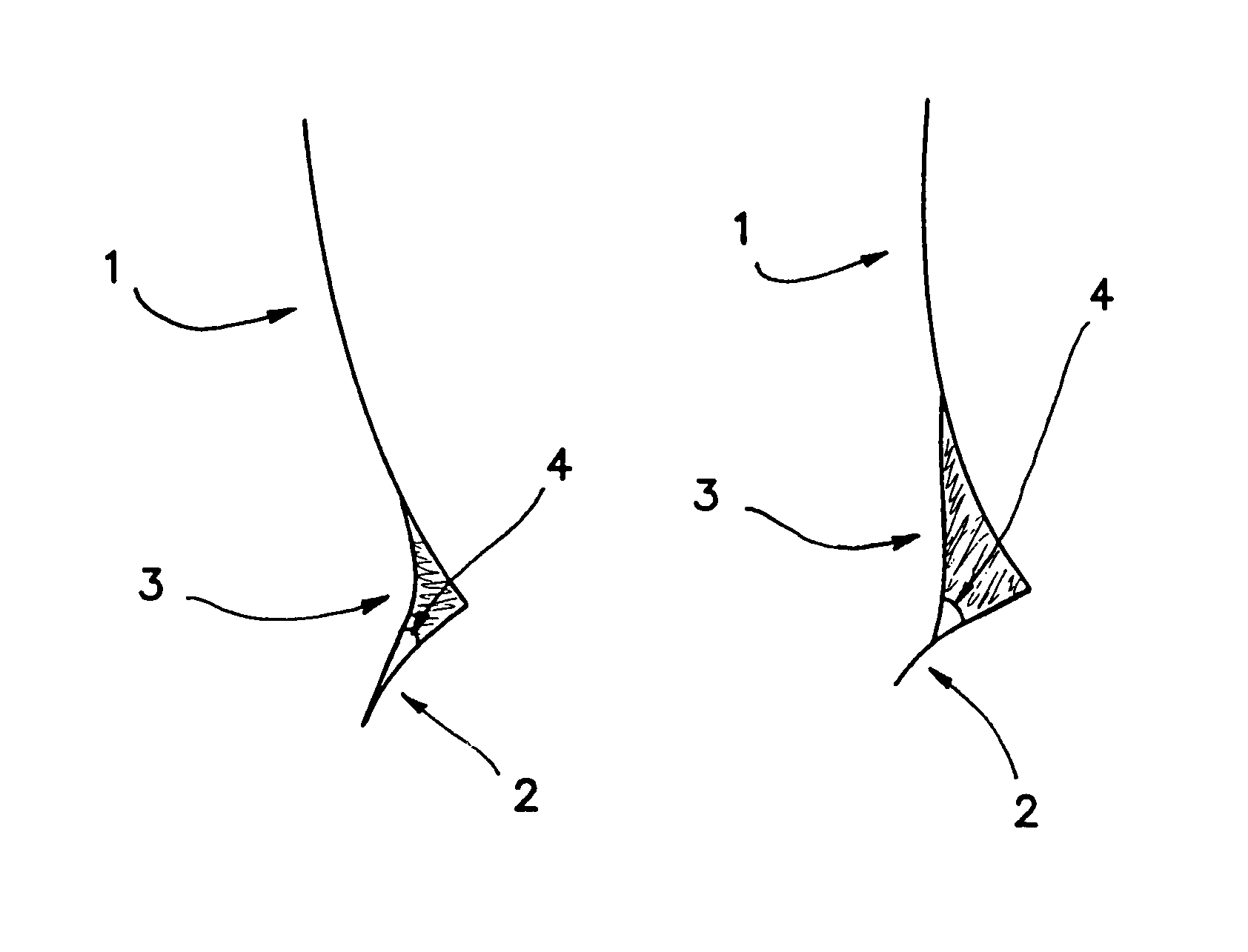 Compositions for delivery of therapeutics into the eyes and methods for making and using same