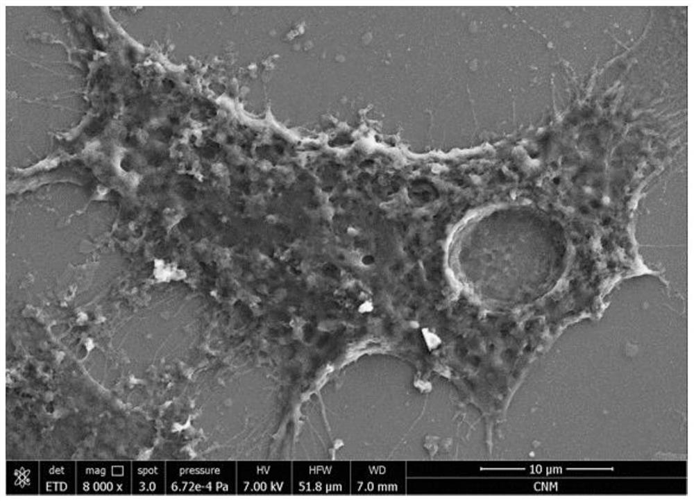 Application of rust rot disease ginseng extract in preparation of medicine for treating tumor