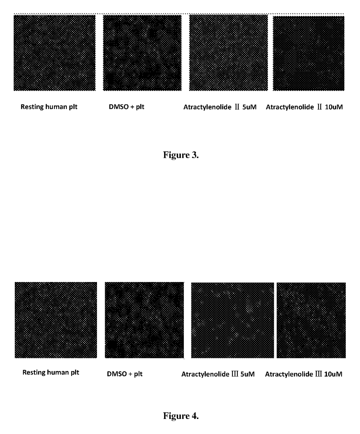 Use of atractylenolide compound or its derivatives and a medicament for inhibiting platelet aggregation