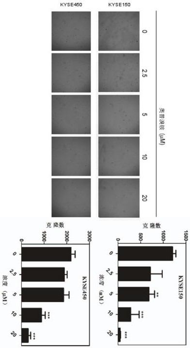 Application of otilonium bromide to preparation of antitumor medicines