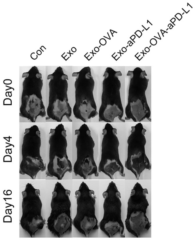 Tumor vaccine combining exosome with immune checkpoint blocker and preparation method thereof