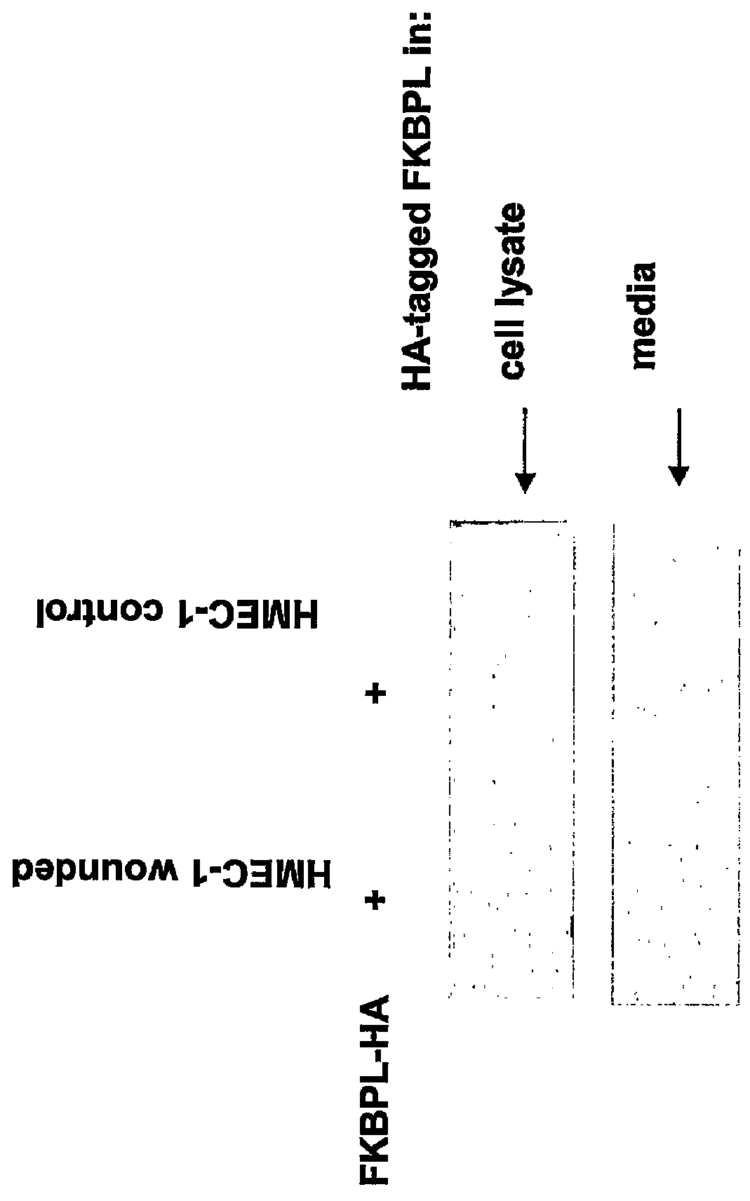 FKBP-L and uses thereof