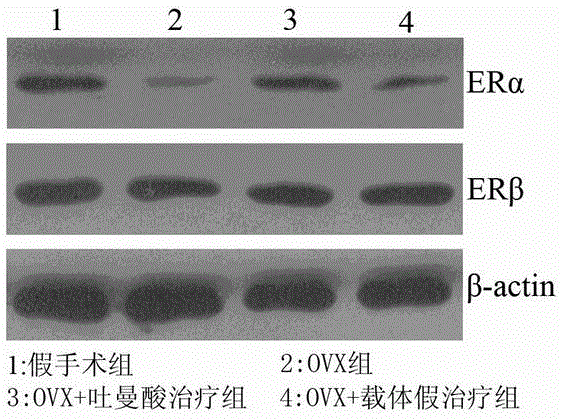 Application of tormentic acid in preparation of medicine for treating or preventing Alzheimer disease caused by estrogen lack