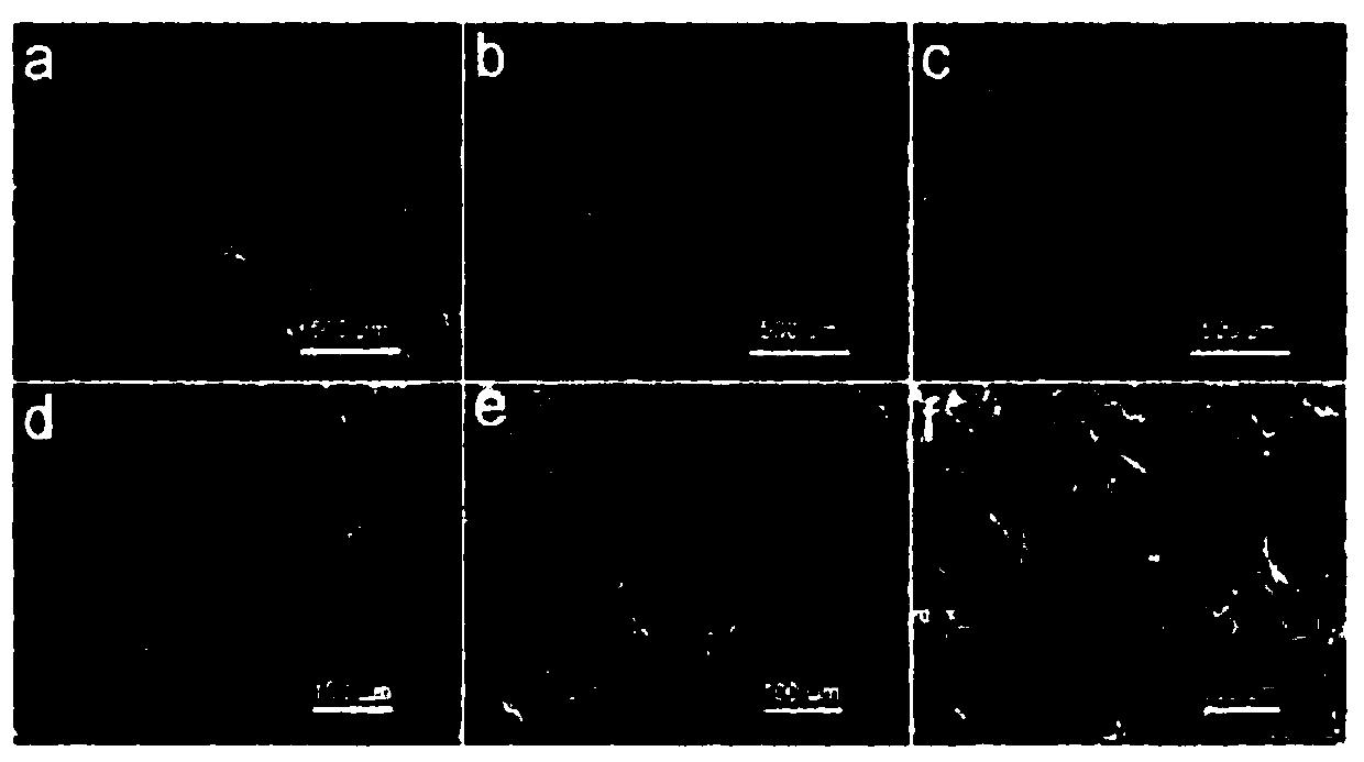 Wound dressing based on hydrogel-core-shell microspheres and preparation method thereof