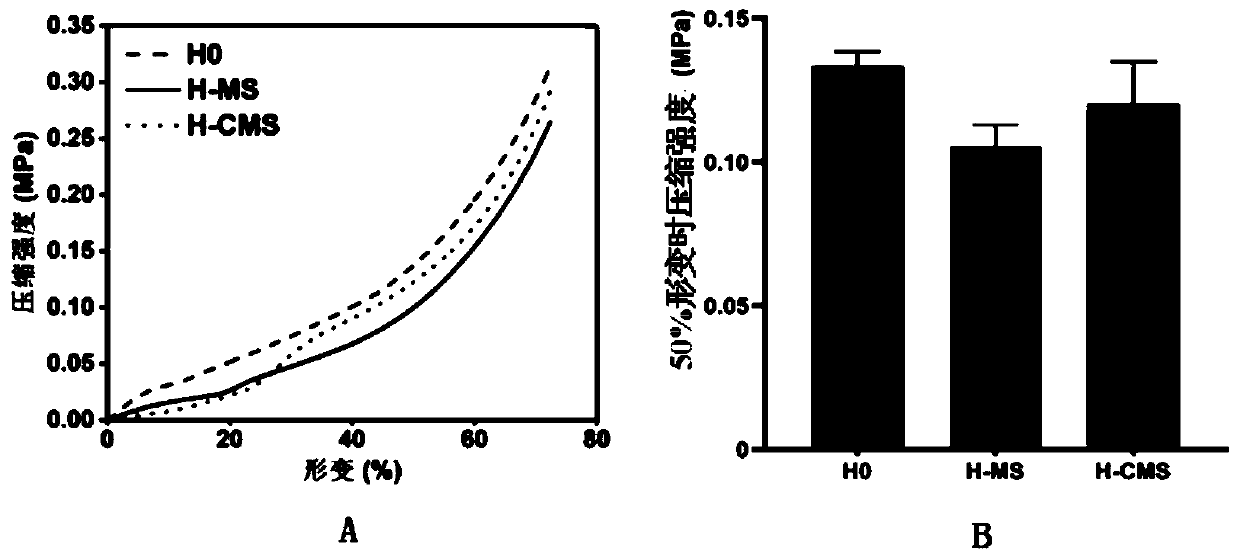 Wound dressing based on hydrogel-core-shell microspheres and preparation method thereof