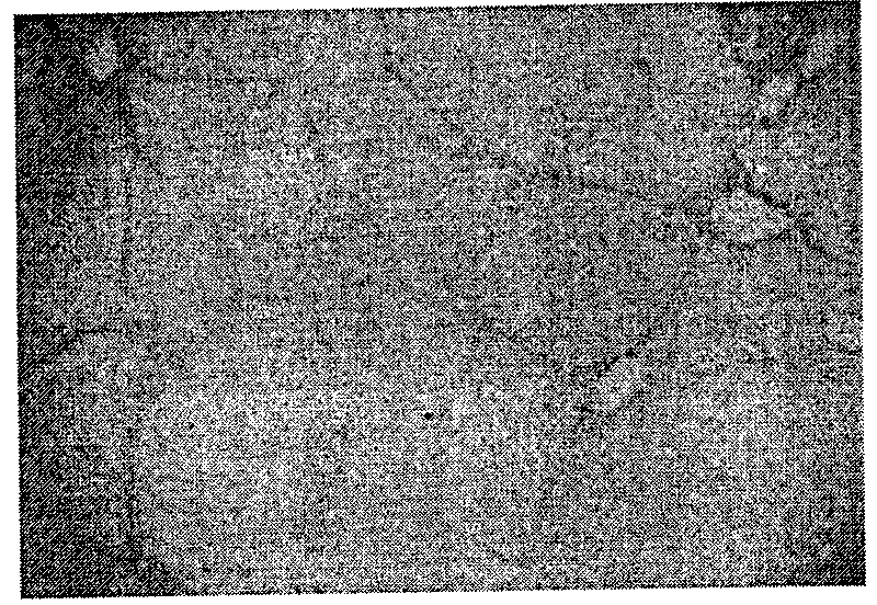 Chinese medicine composition for treating hepatic fibrosis, and preparation method and applications thereof