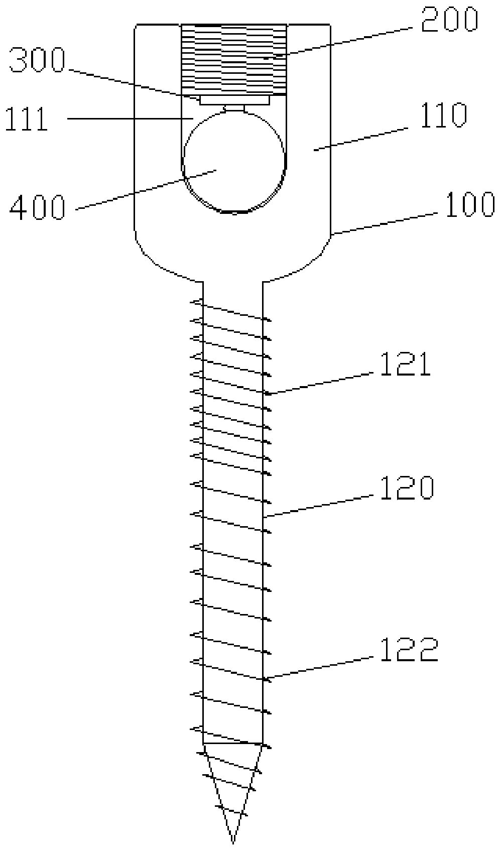 Pedicle screw fixation device and system for thoracolumbar spine posterior orthopedics