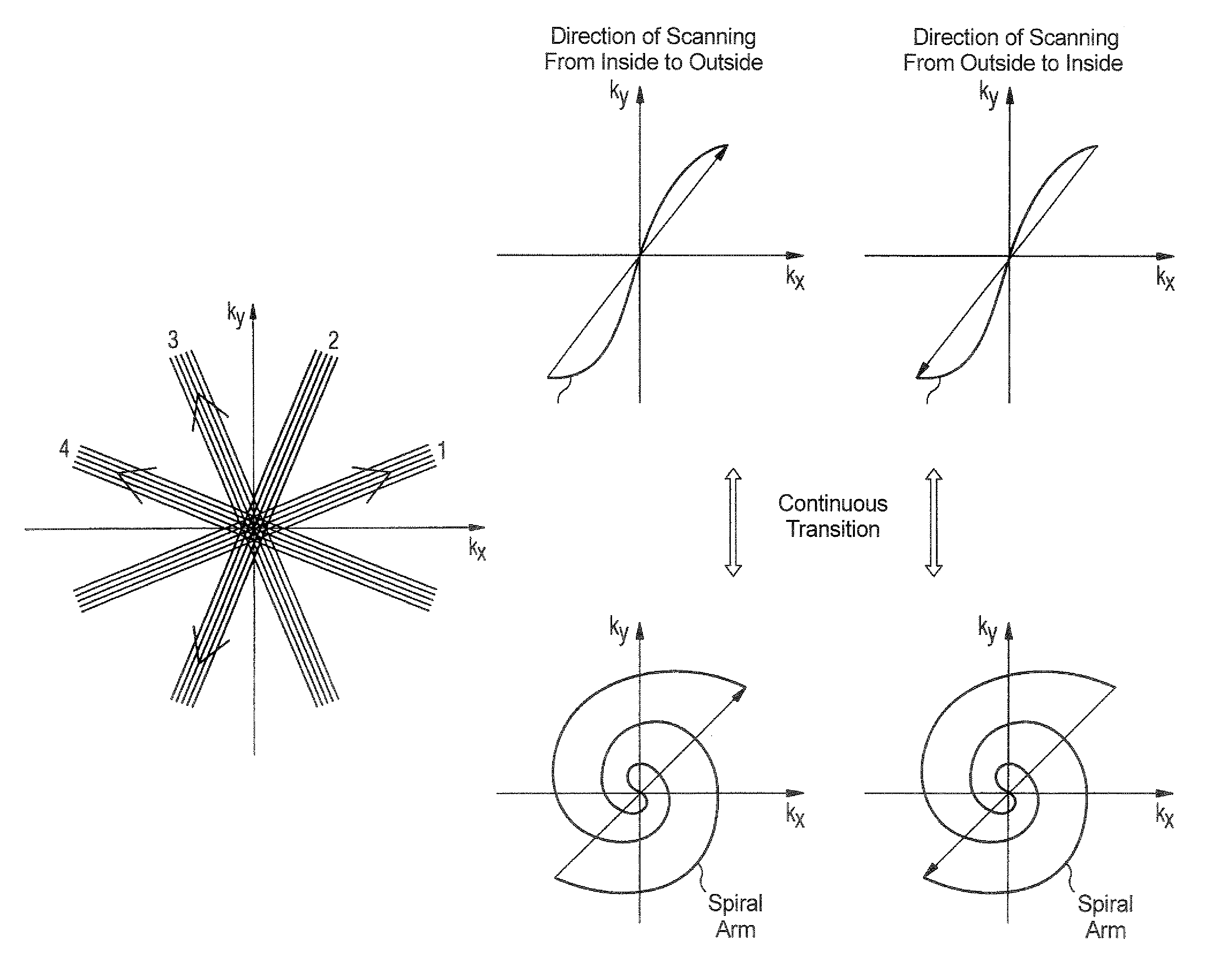 Magnetic resonance imaging apparatus and method wherein streak artifacts are minimized in modular k-space scanning