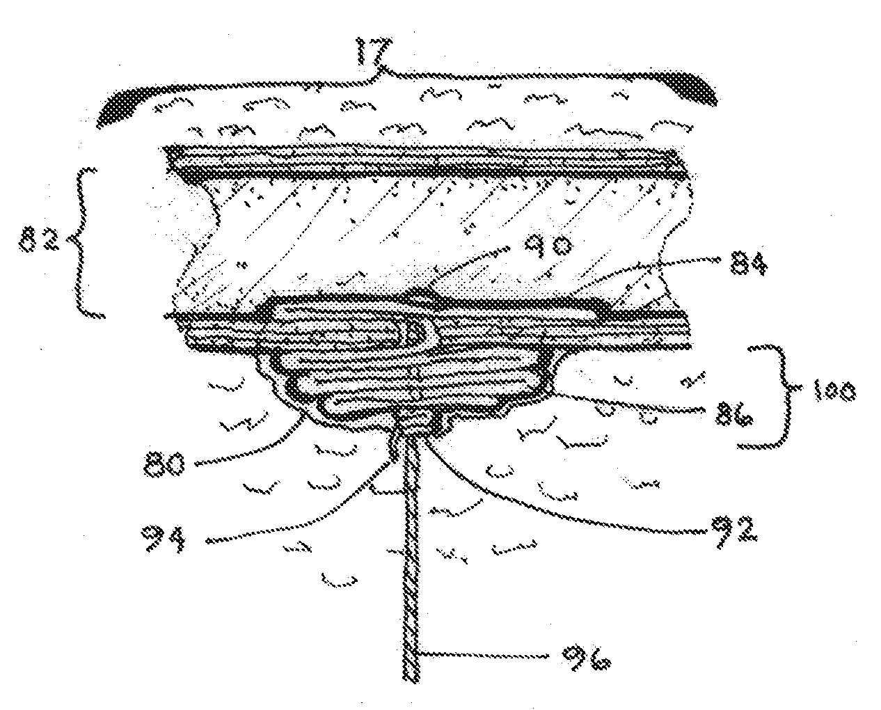 Closure medical device