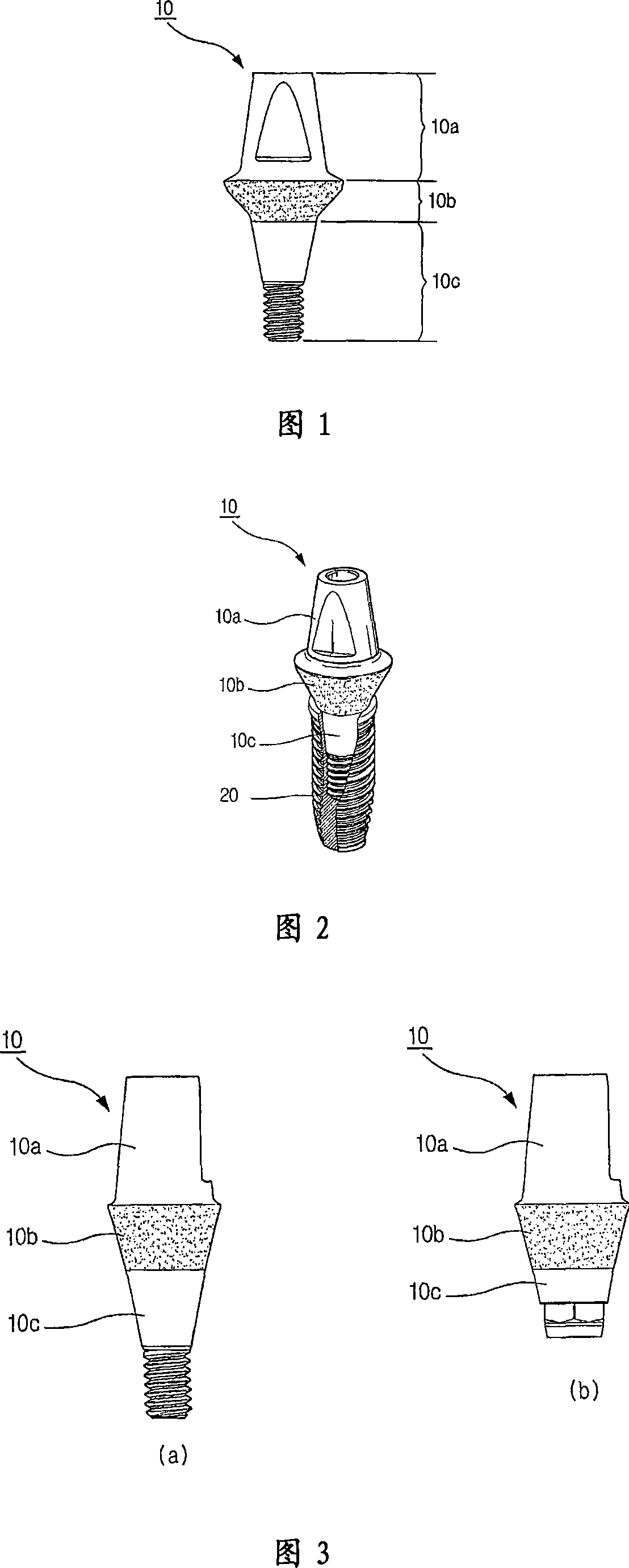 Abutment for implant