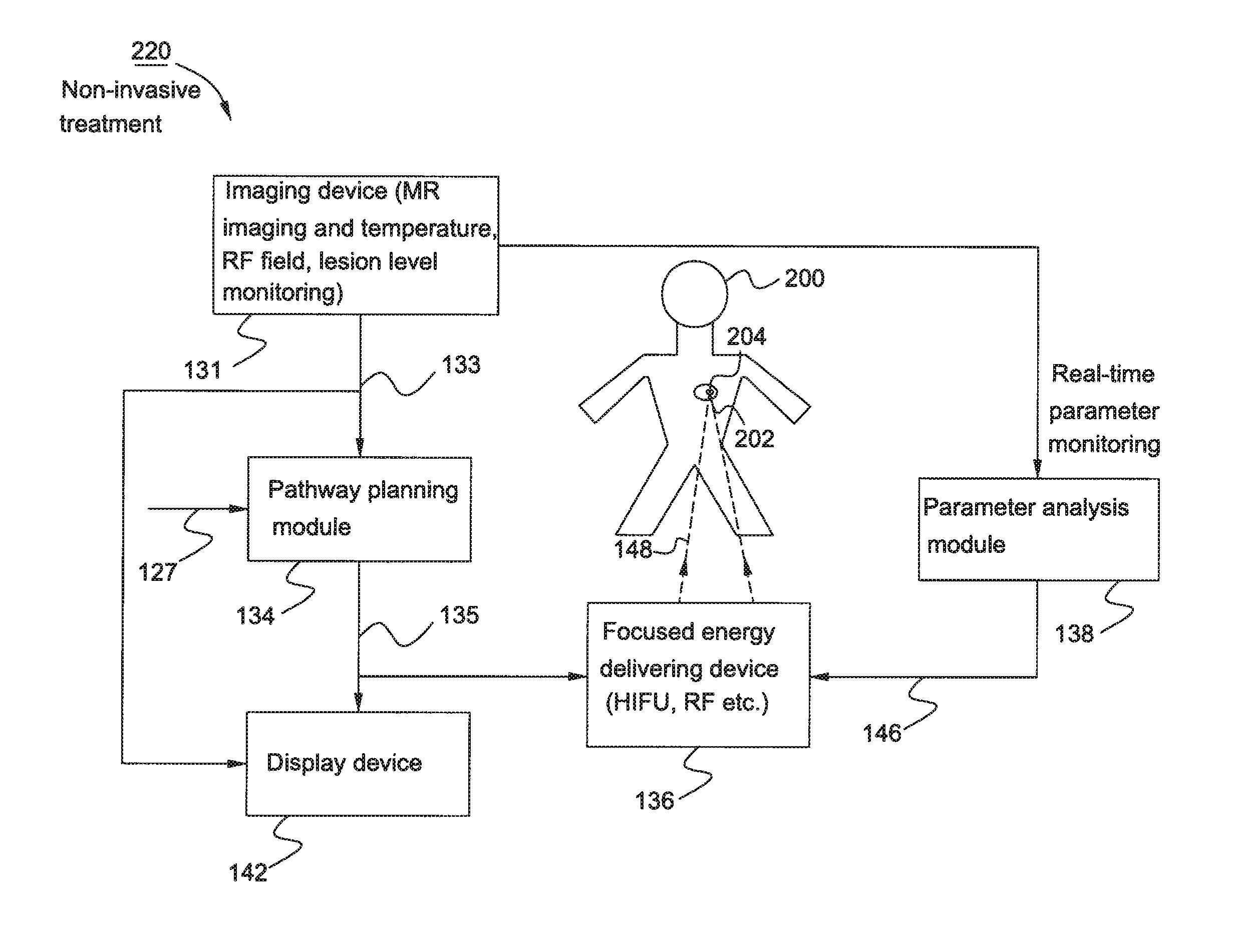 System and method for non-invasive treatment of cardiac arrhythmias