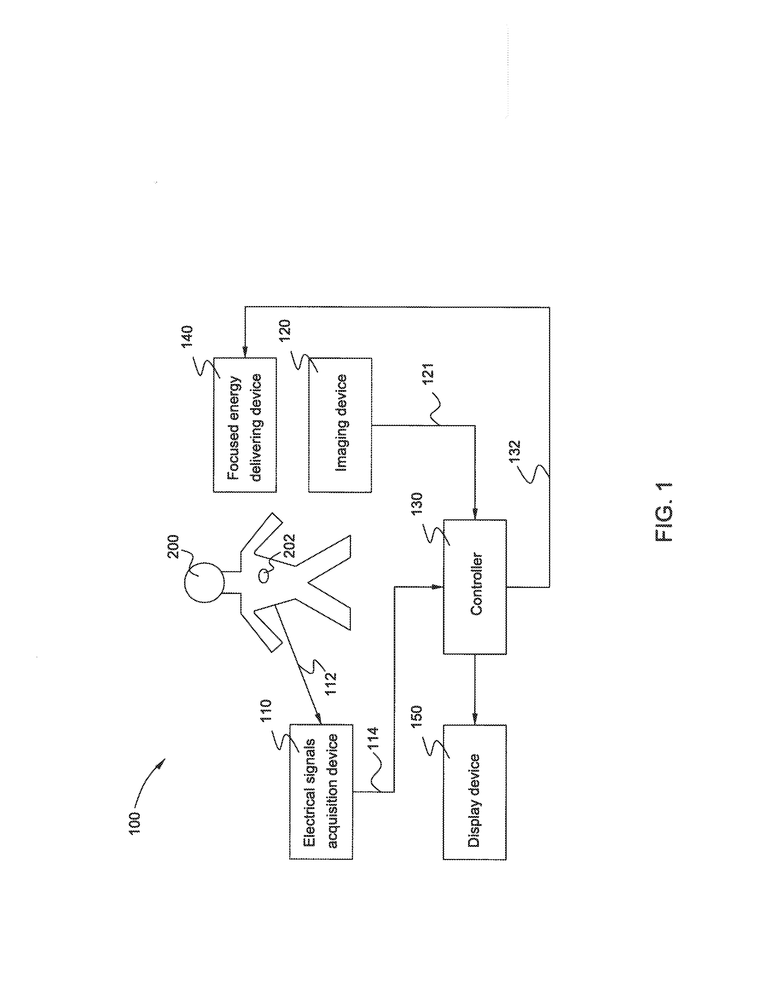 System and method for non-invasive treatment of cardiac arrhythmias