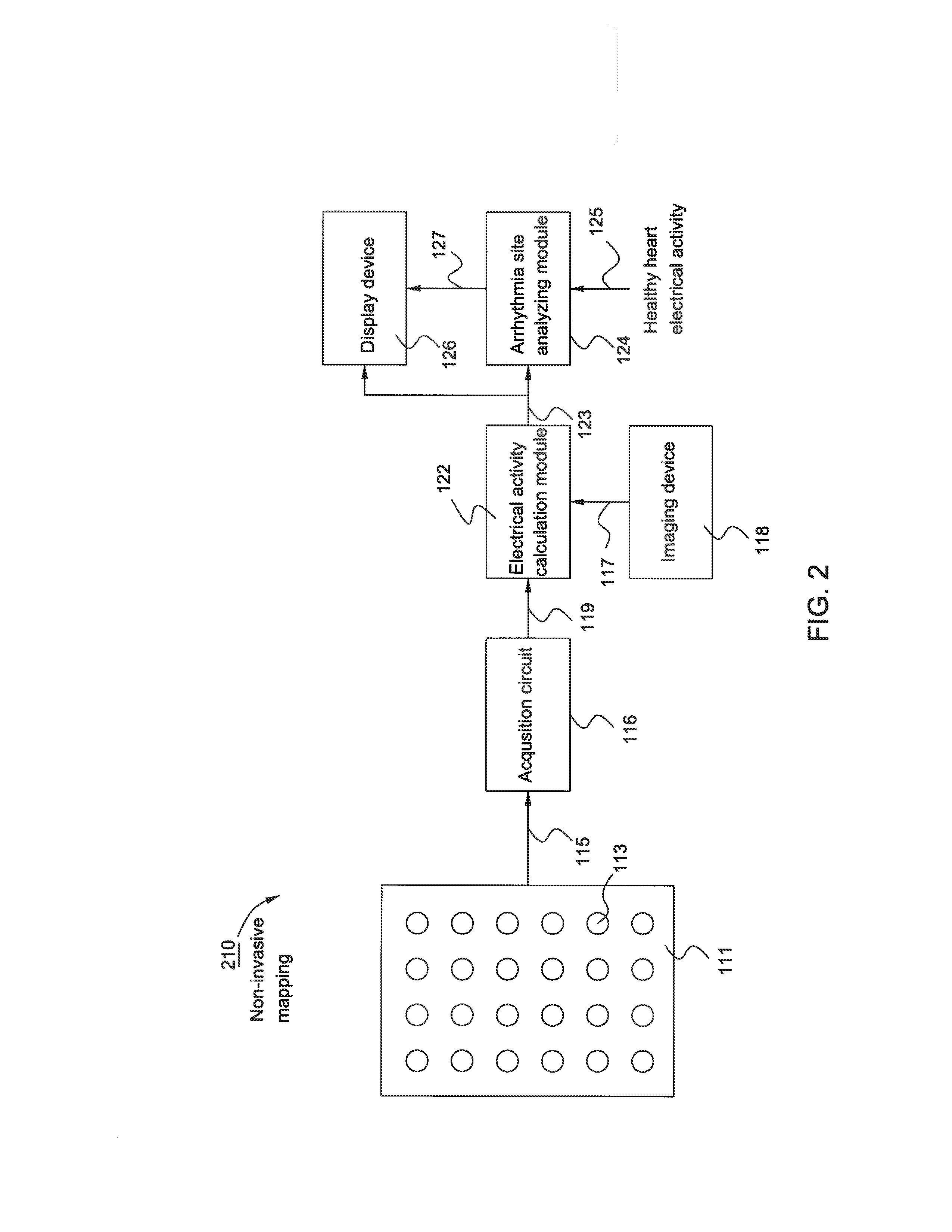 System and method for non-invasive treatment of cardiac arrhythmias