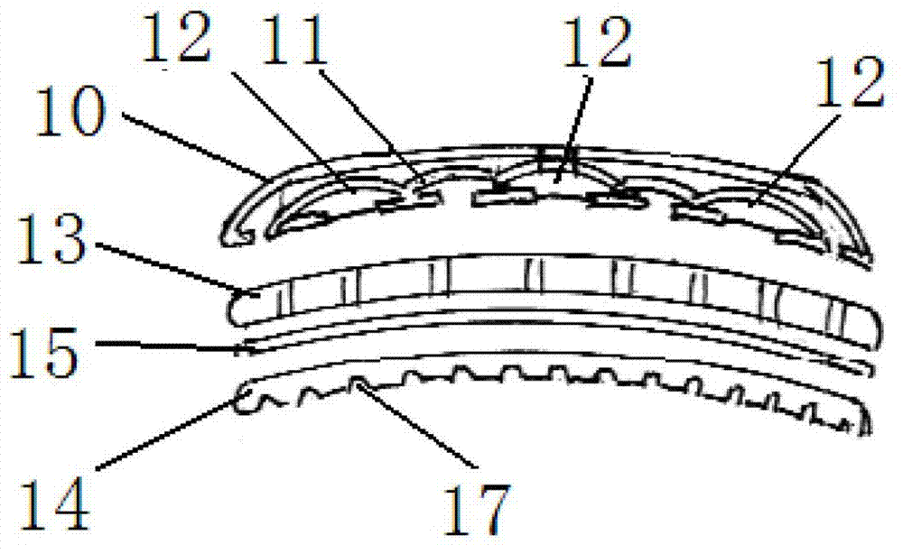 External bone splint device for treating bone injury