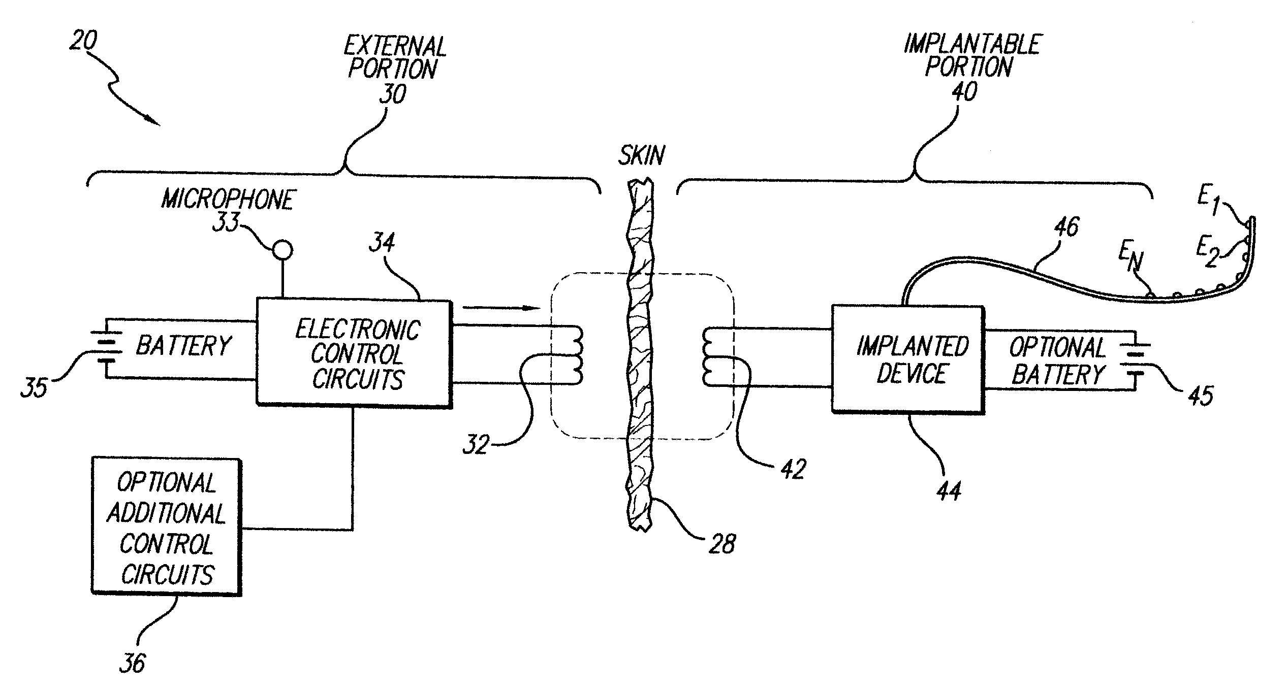 Cochlear Stimulation Device