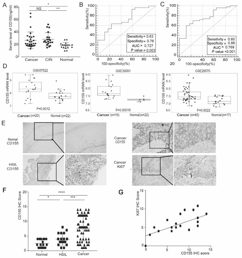 Application of CD155 in diagnosis and treatment of cervical cancer