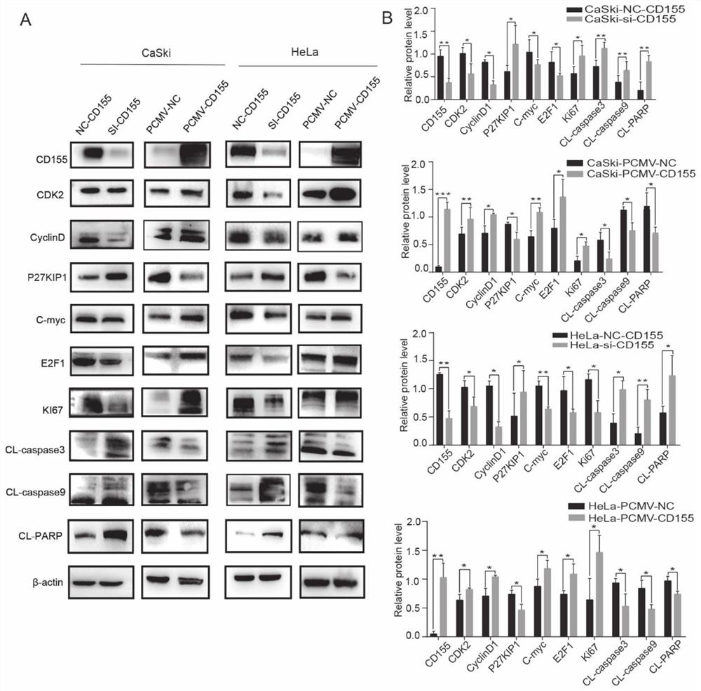 Application of CD155 in diagnosis and treatment of cervical cancer