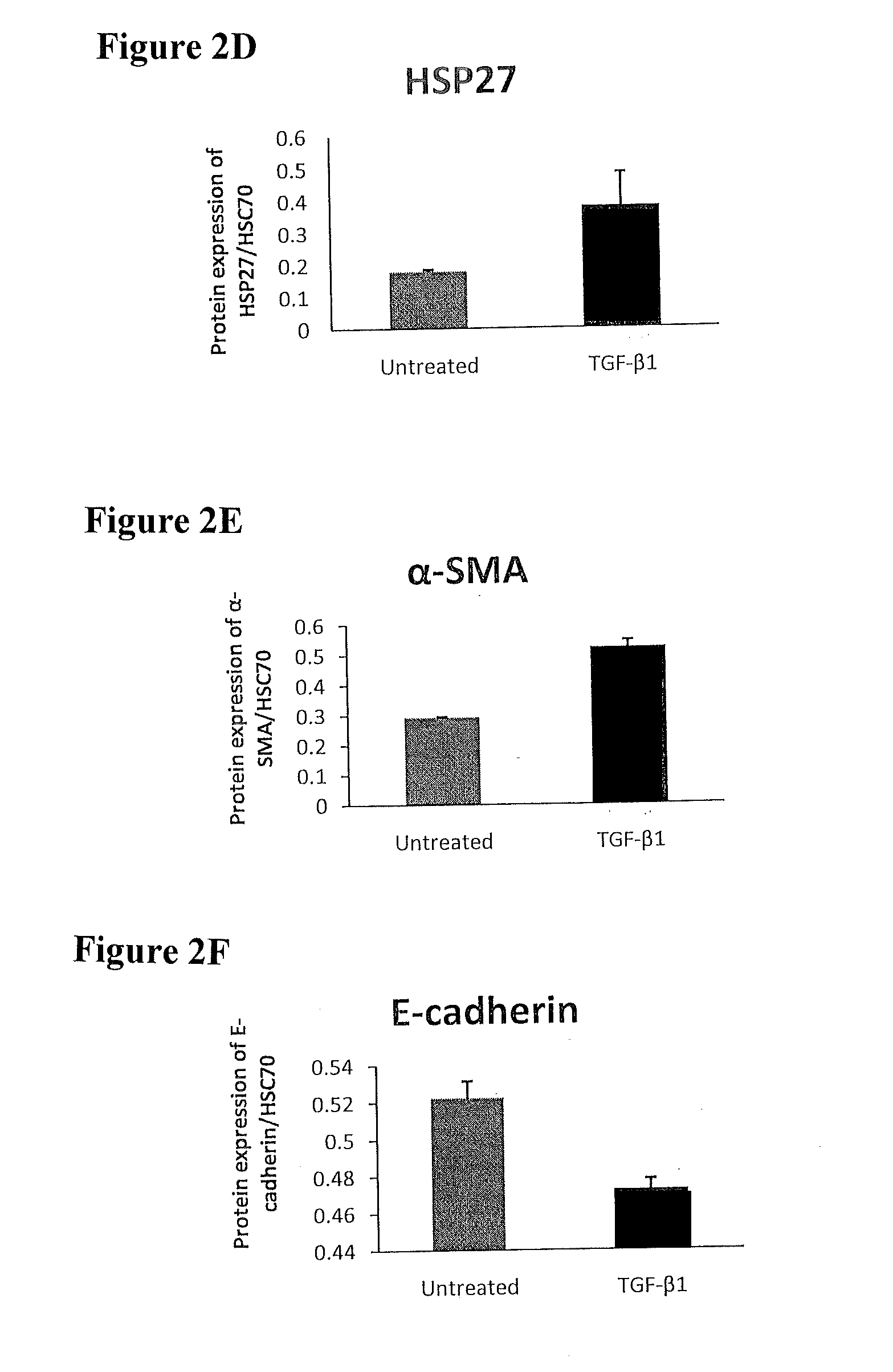 Treatment of Pulmonary and Pleural Fibrosis Using HSP27 Inhibitors