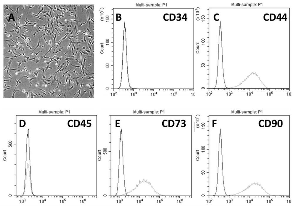 A kind of mesoderm lineage mesenchymal stem cell derived from pluripotent stem cell and preparation method thereof