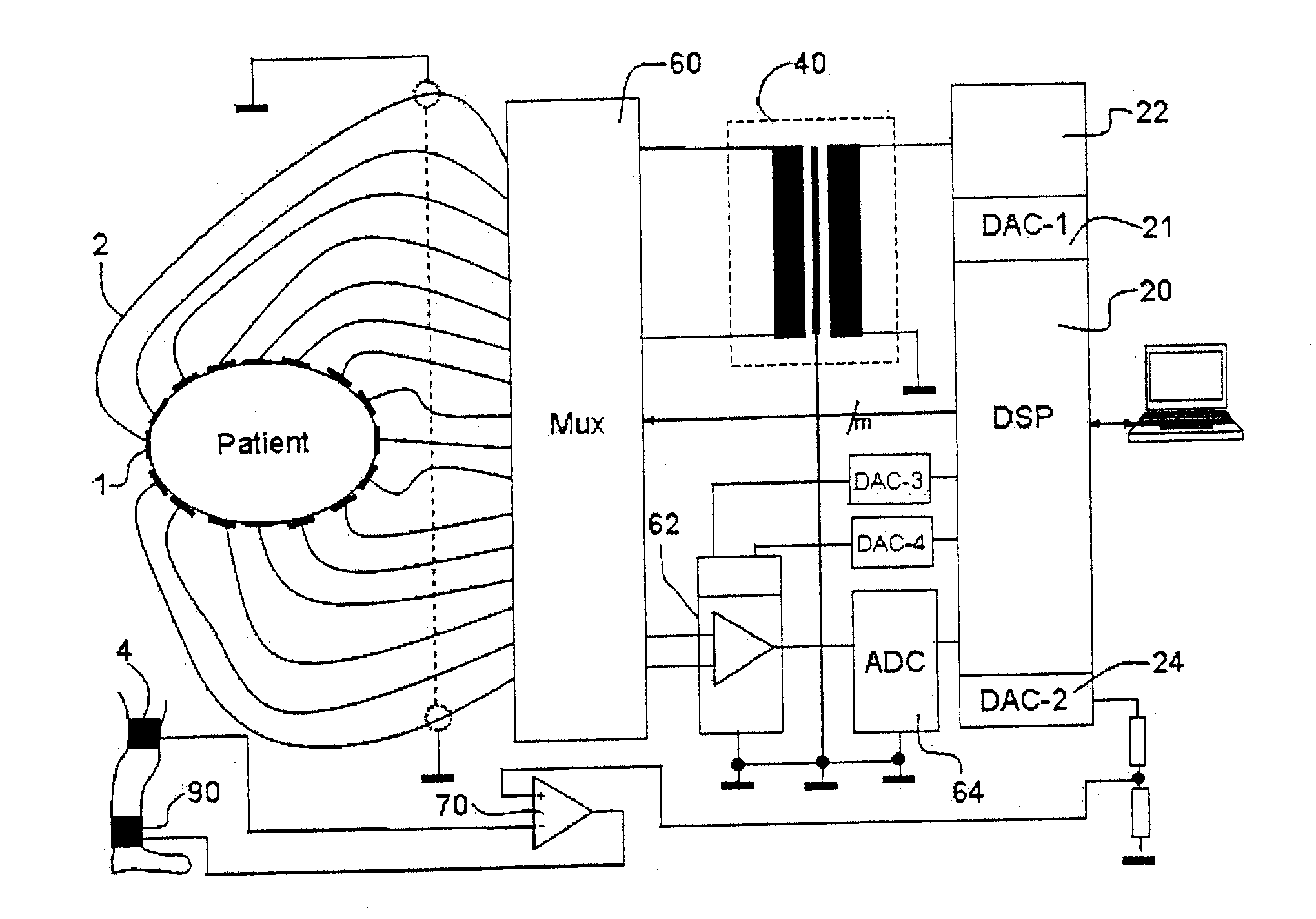 Electroimpedance tomograph with common-mode signal suppression